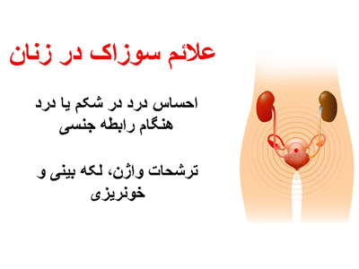 علائم بیماری های زنان